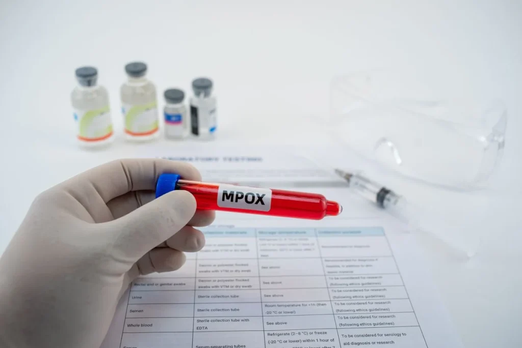 Alerta Mpox no Brasil: 8 Estados em Atenção Máxima e Ações Urgentes para Conter Novos Casos