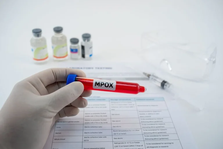 Alerta Mpox no Brasil: 8 Estados em Atenção Máxima e Ações Urgentes para Conter Novos Casos